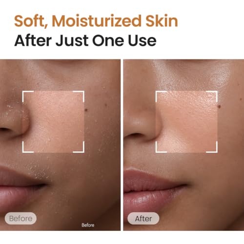 Honey Sugar Food Mask 4.23 oz - Skin appearance before and after