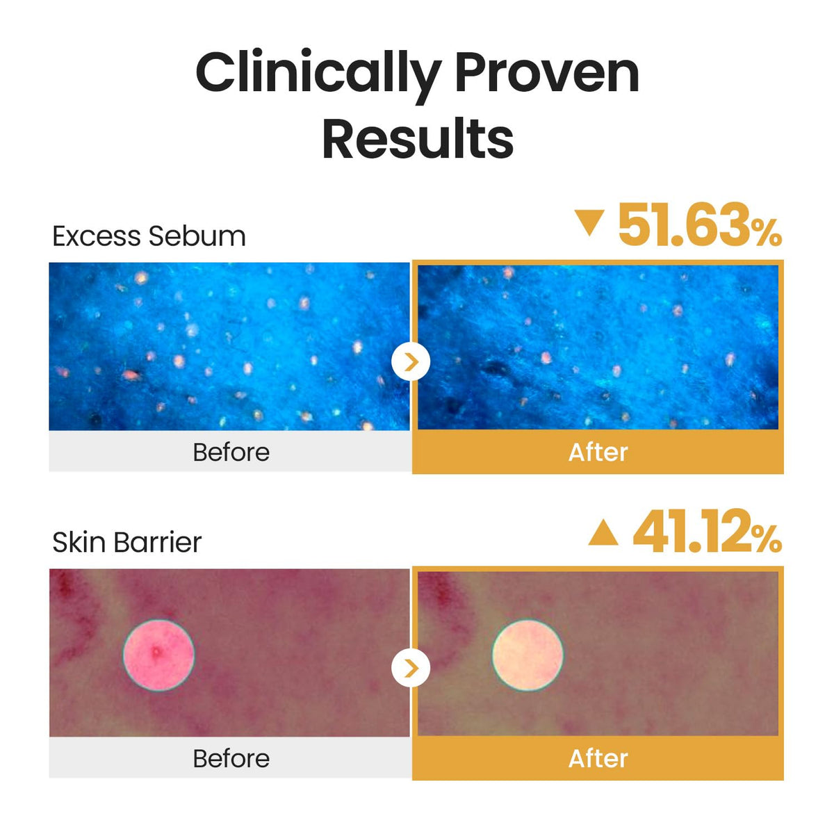 SKINFOOD Royal Honey Propolis Enrich Essence 50mL original Amazon clinical results