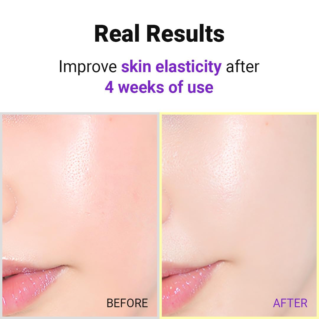 Isntree Hyper Retinol EX 1.0 Serum 20mL official four week appearance demonstration