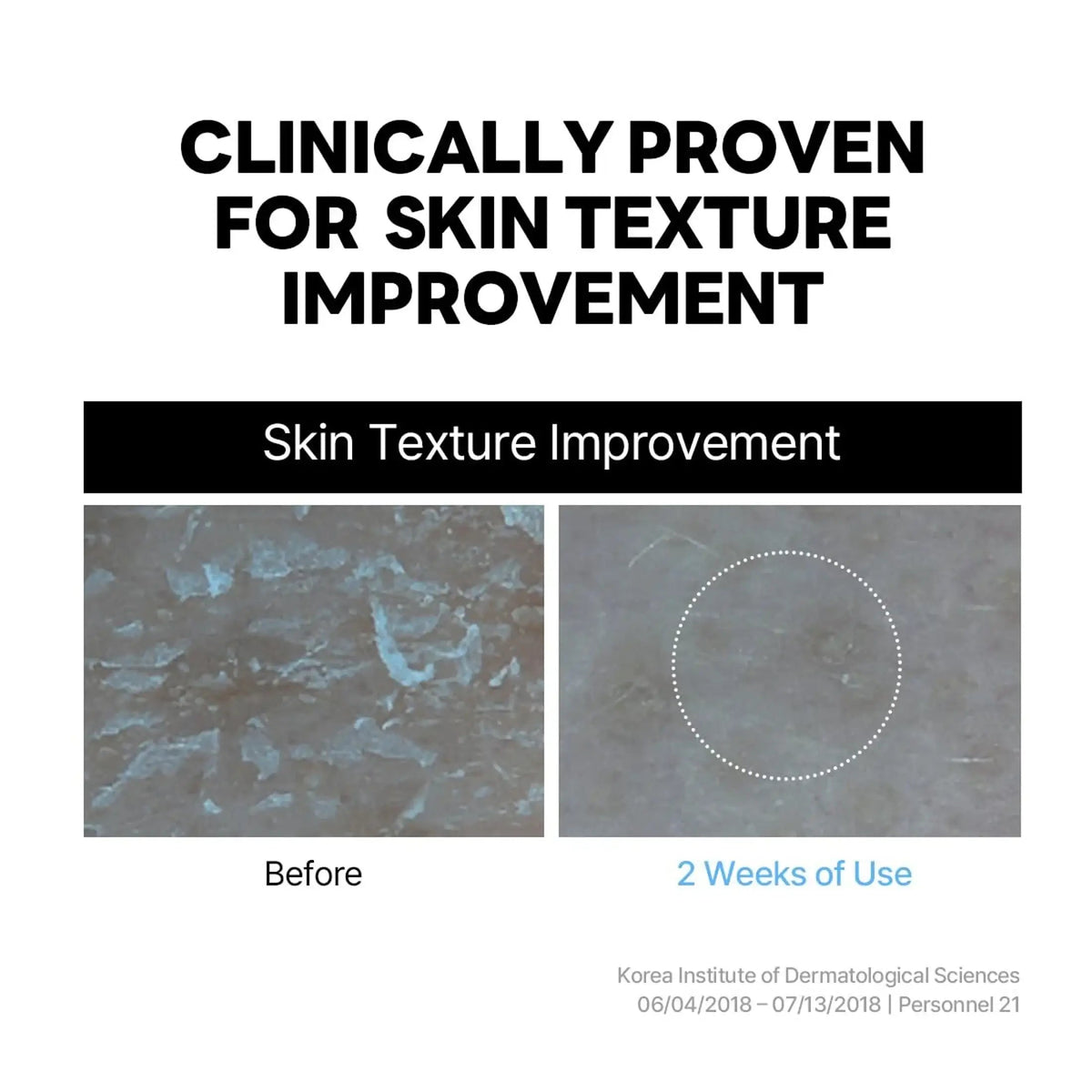 Clinically proven for skin texture improvement with before and after images showing results after 2 weeks of use