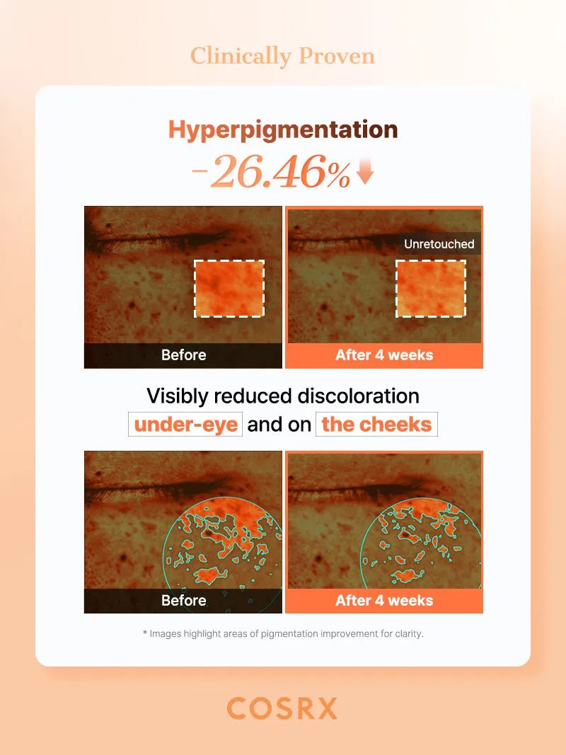 COSRX 5 PDRN Collagen Eye Patch gallery-6 product information