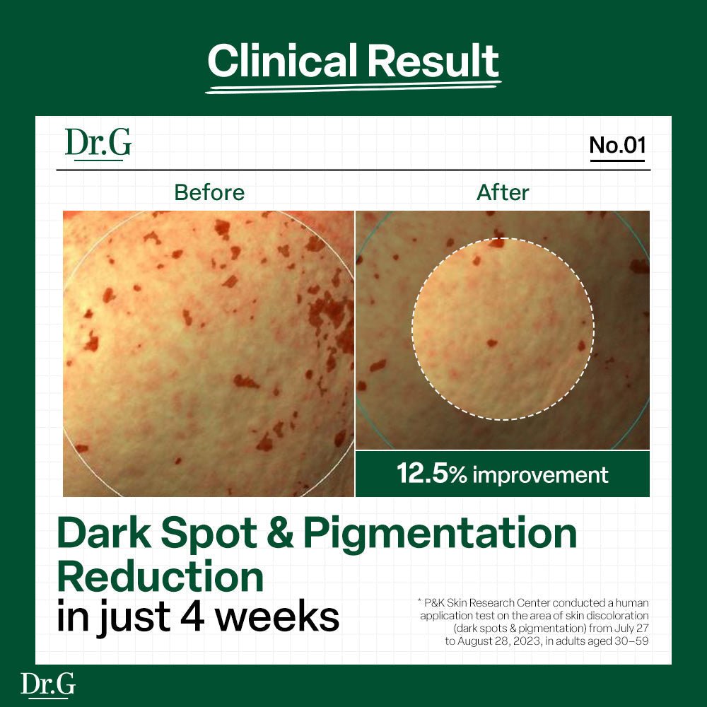 Dr.G Black Snail Glutathione Tone Up Sun SPF50+ PA++++ 50ml β four-week appearance test results