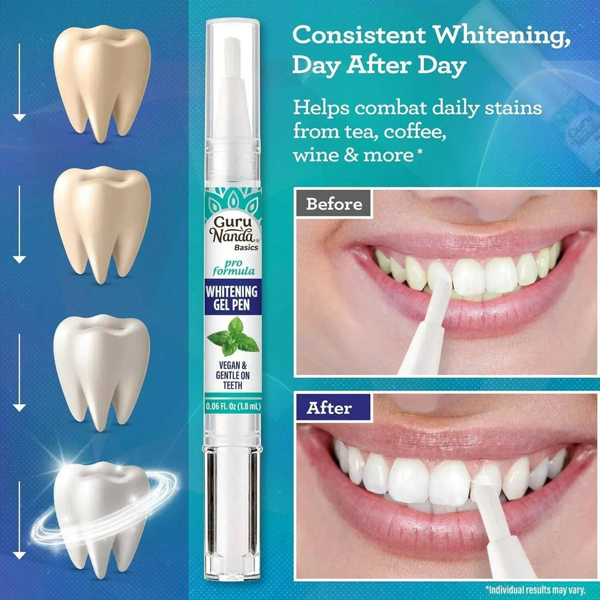 GuruNanda LLC β wholesale Teeth Whitener β Whitening Gel Pen β 1.8mL2