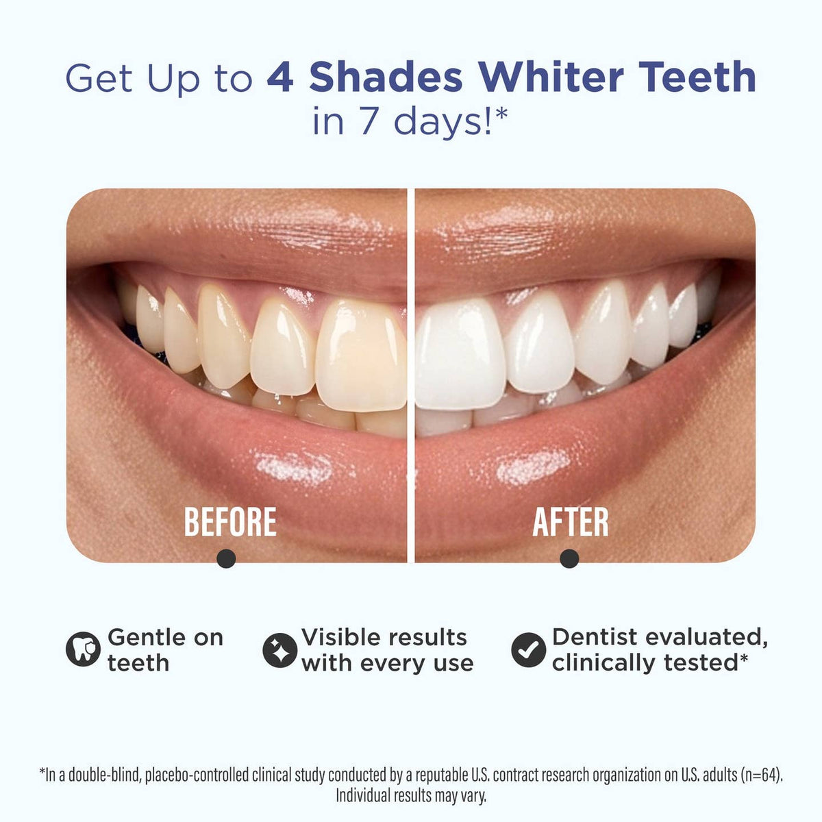 GuruNanda LLC β wholesale Teeth Whitener β Whitening Strips β 7 Day Treatment1