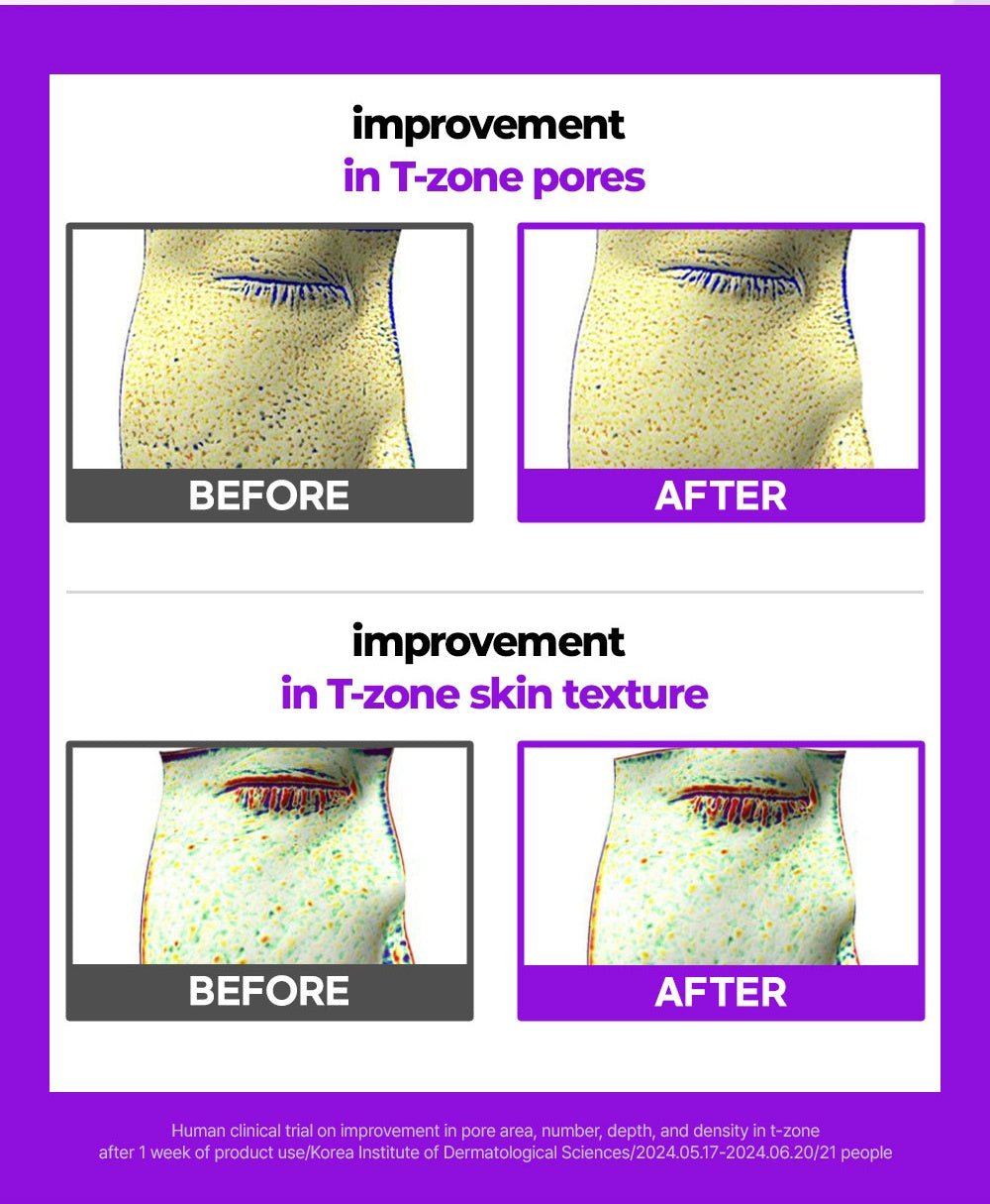 FATION Nosca9 Pore Enhancing Serum: tzone overview