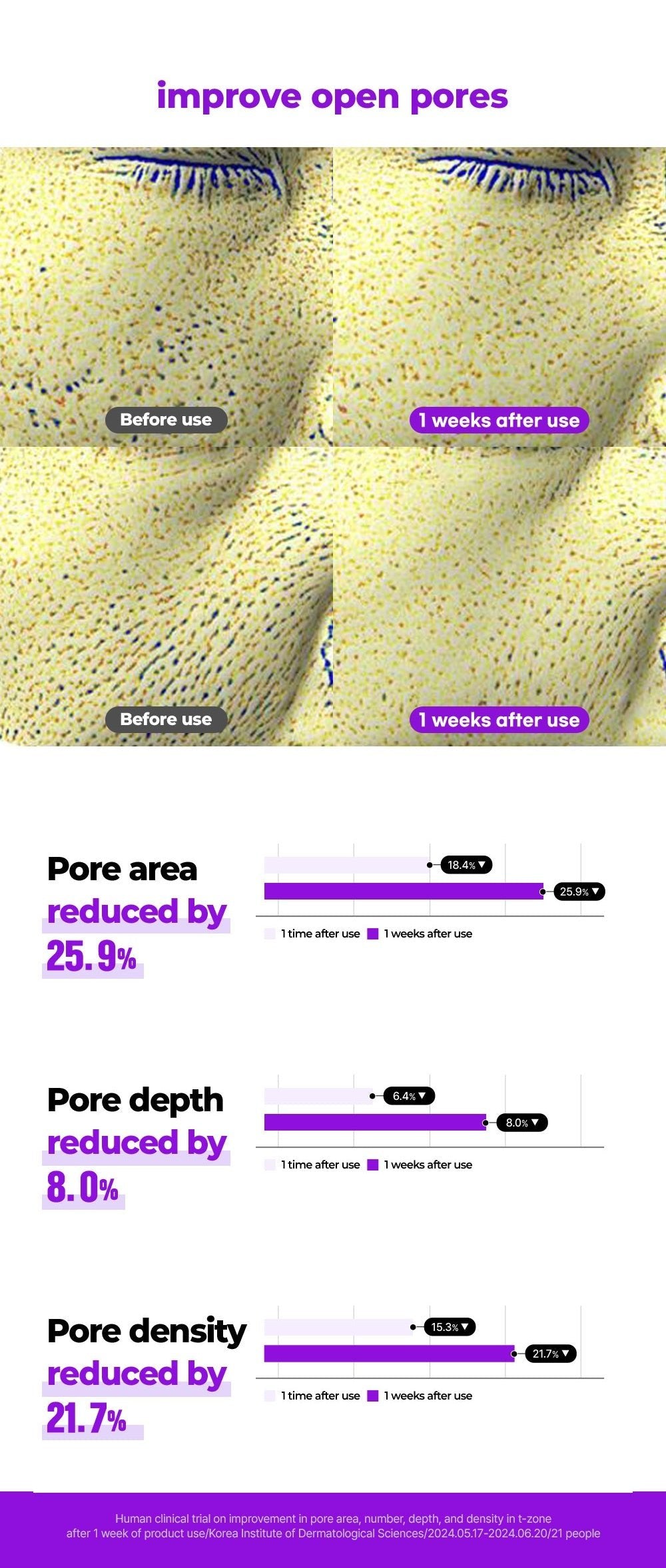 FATION Nosca9 Pore Enhancing Serum: open pore measurements