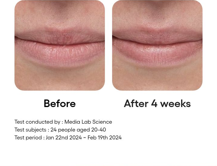 LANEIGE Bouncy and Firm Lip Treatment four-week before-and-after with study details
