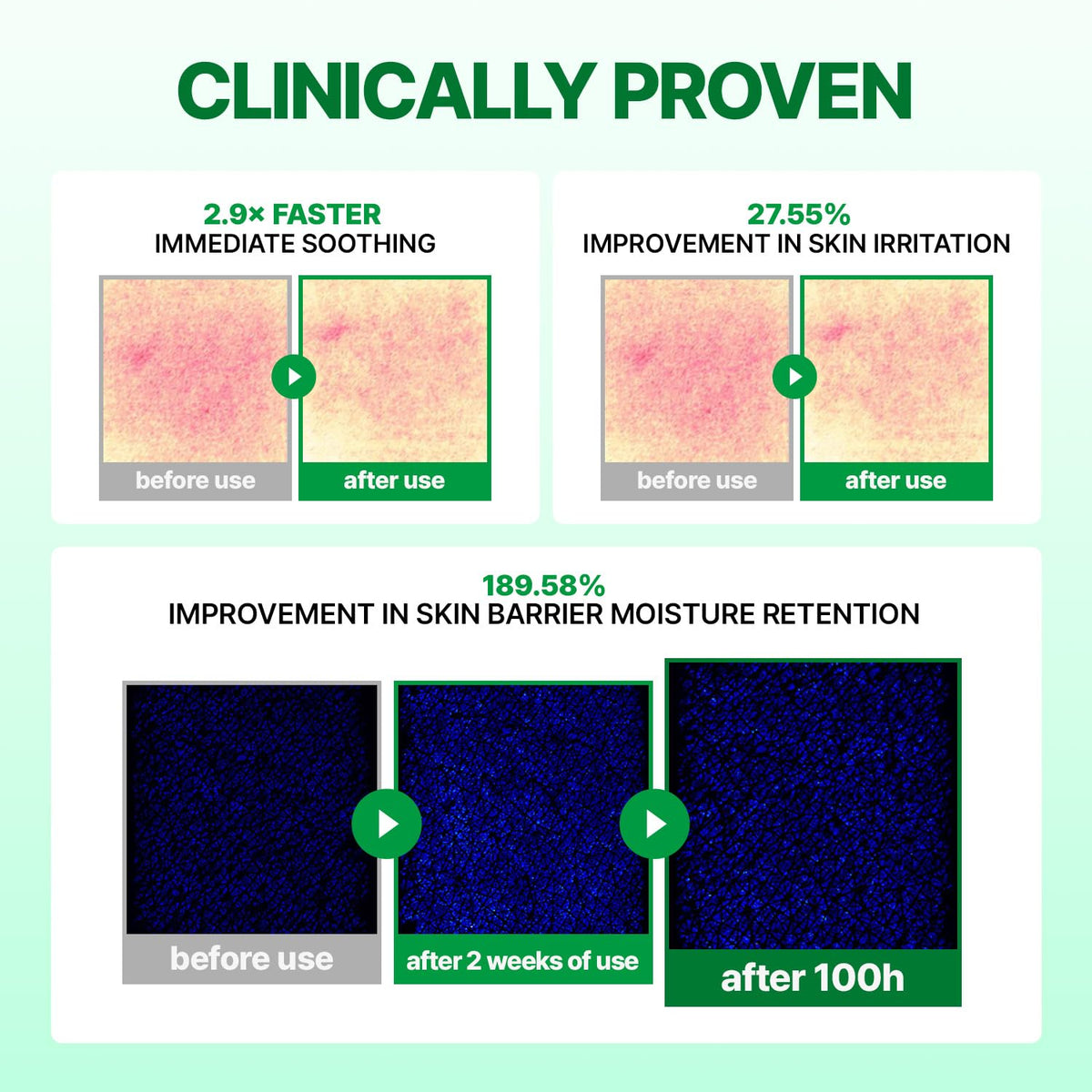 make p:rem Inteca Soothing Cream β clinical hydration results