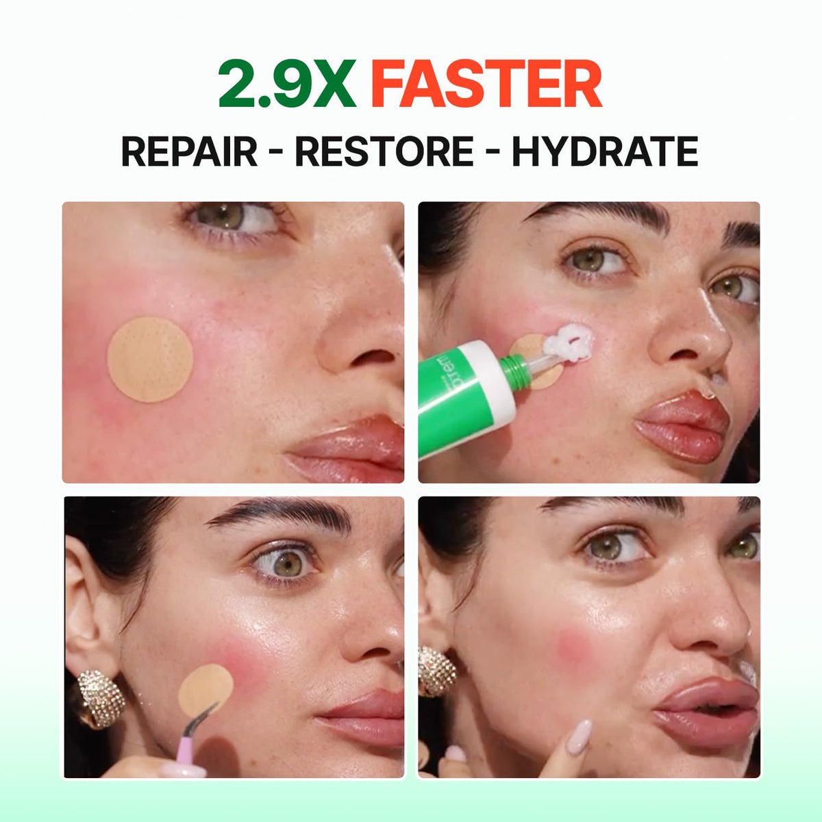 make p:rem Inteca Soothing Cream β faster repair results
