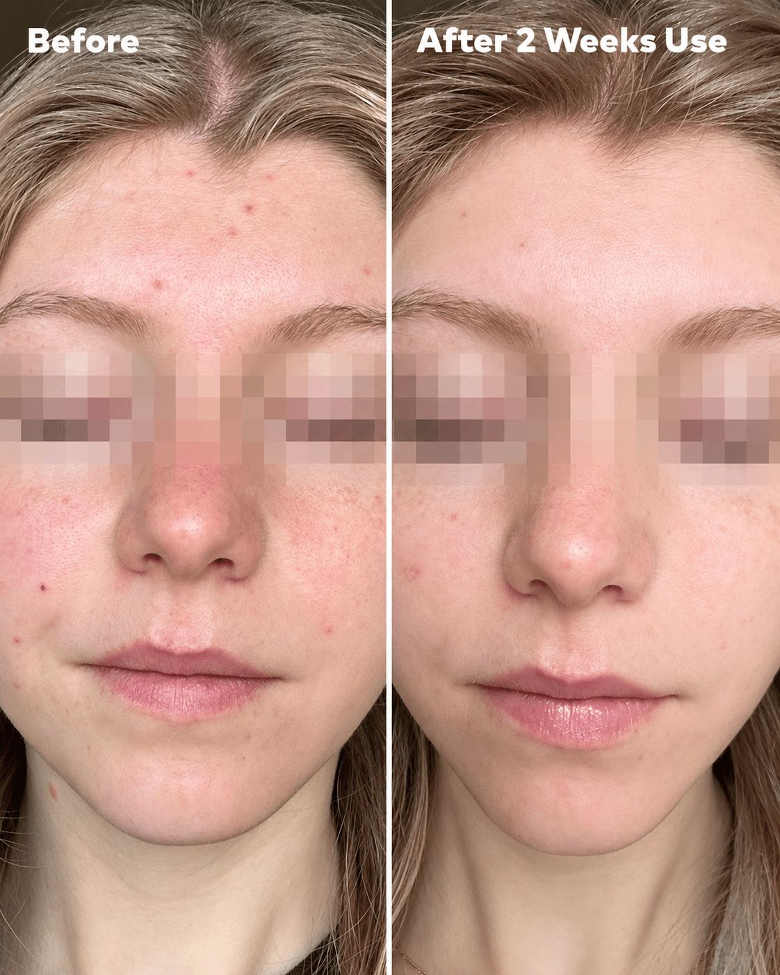 MakeUp Eraser Silver Infused Mini PRO before and after two weeks close-up