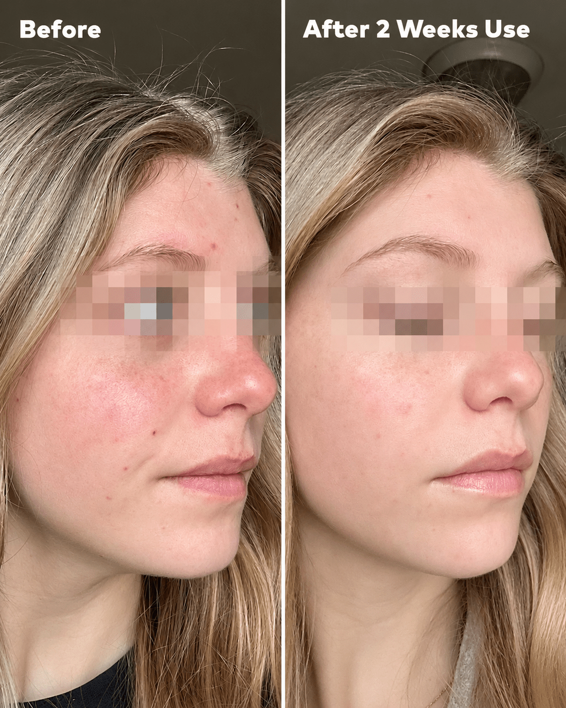 MakeUp Eraser Silver Infused Mini PRO before and after two weeks side profile