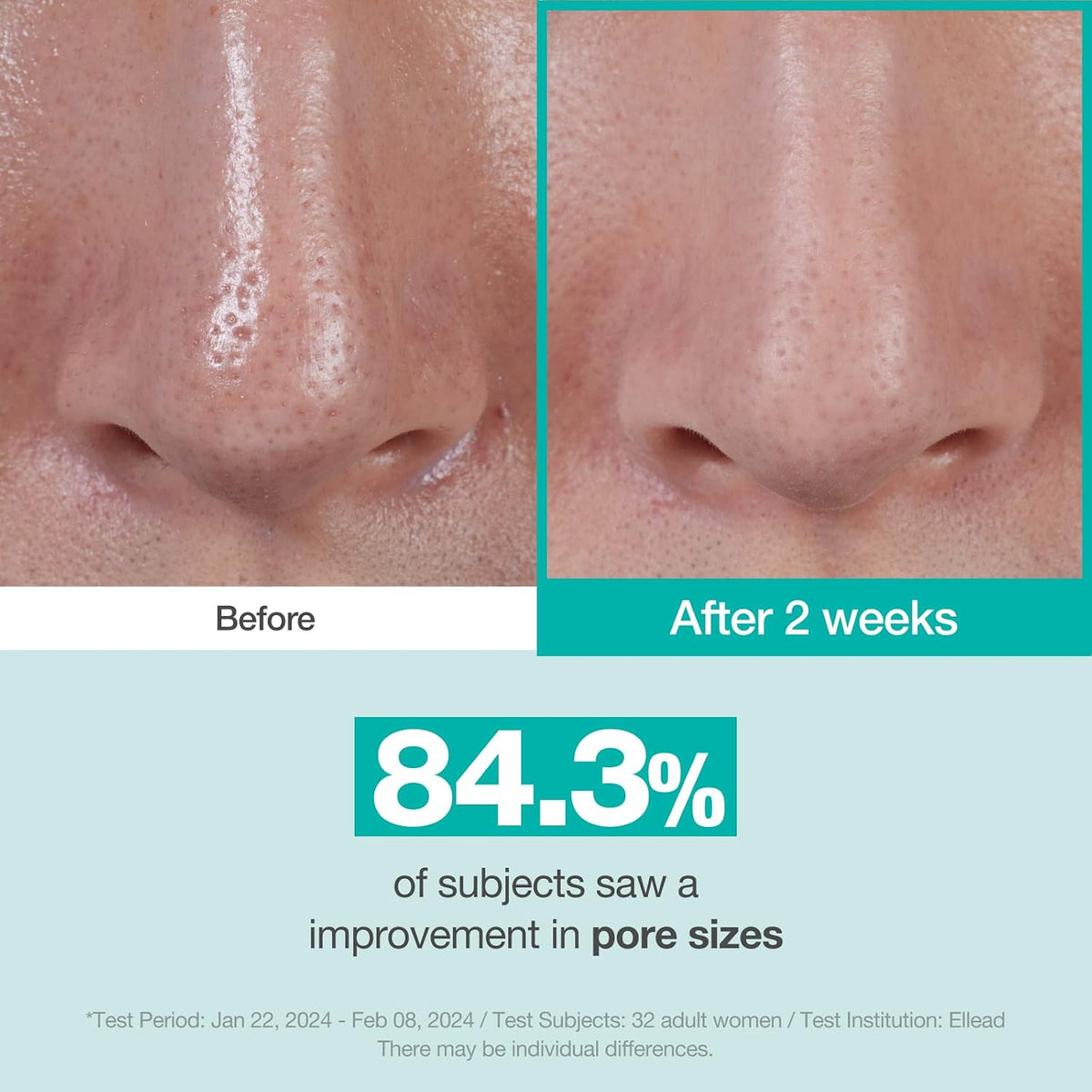 PHYSIOGEL Cica Balance Pore-Control Serum 50ml β Amazon gallery 2