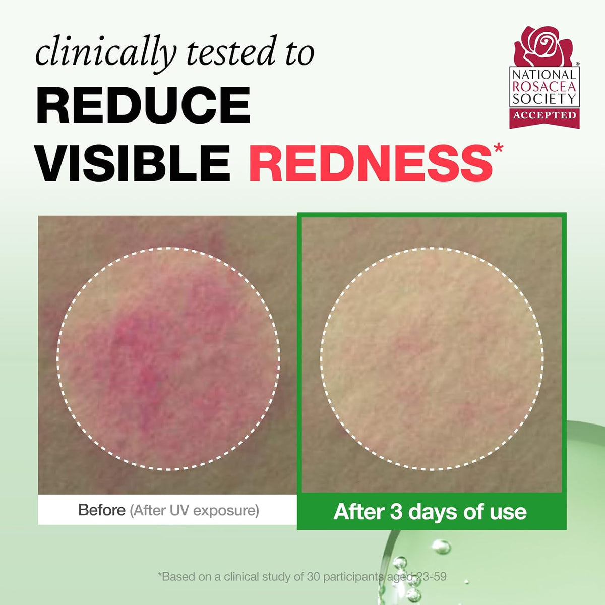 PHYSIOGEL Rosateca Redness Reducing Serum 30ml redness - English Amazon image