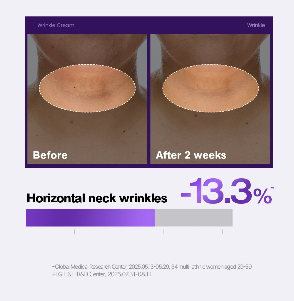 PHYSIOGEL wrinkle official horizontal neck study with original study qualifications