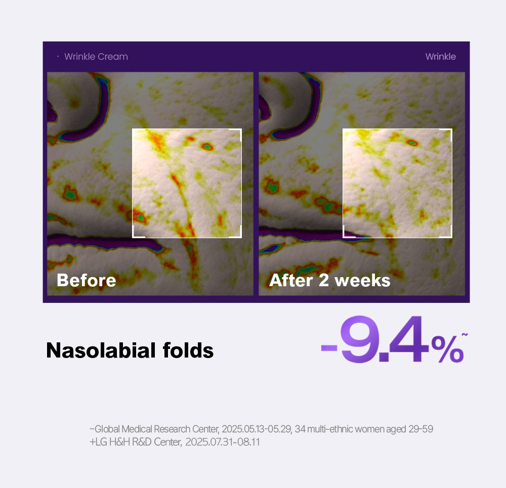 PHYSIOGEL wrinkle official nasolabial study with original study qualifications