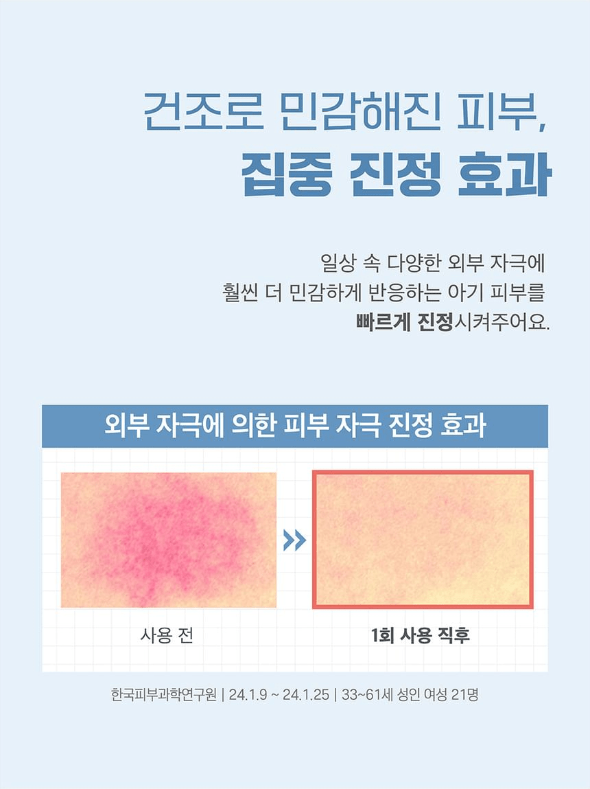 Round Lab Baby Mild Lotion 300ml - Skin soothing test results in Korean.