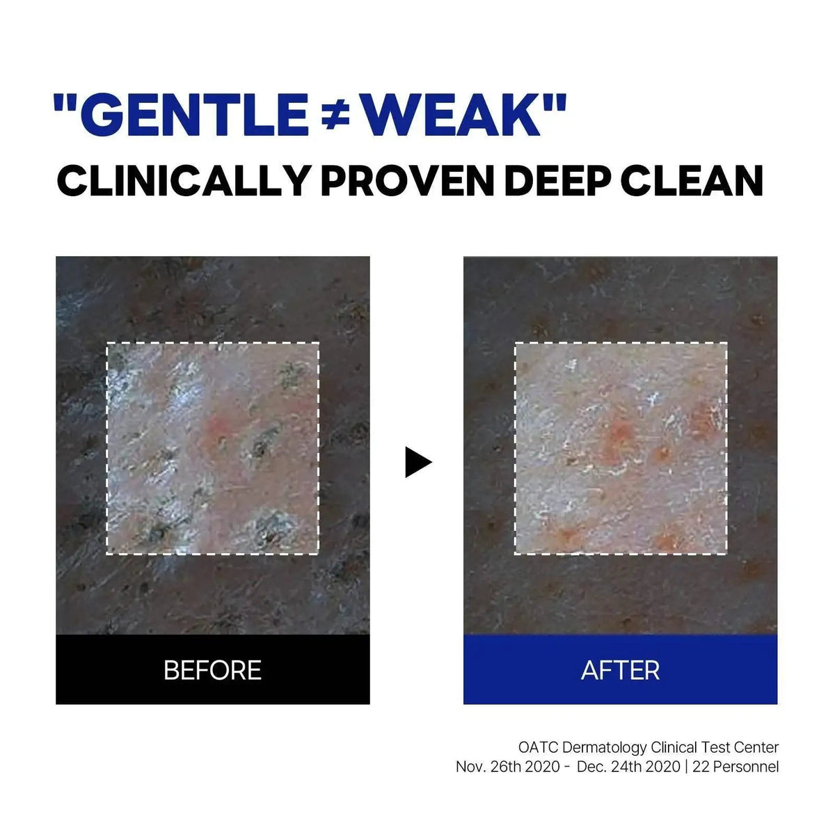 ROUND LAB Gel-to-Foam Cleanser 150ml official product gallery infographic 3