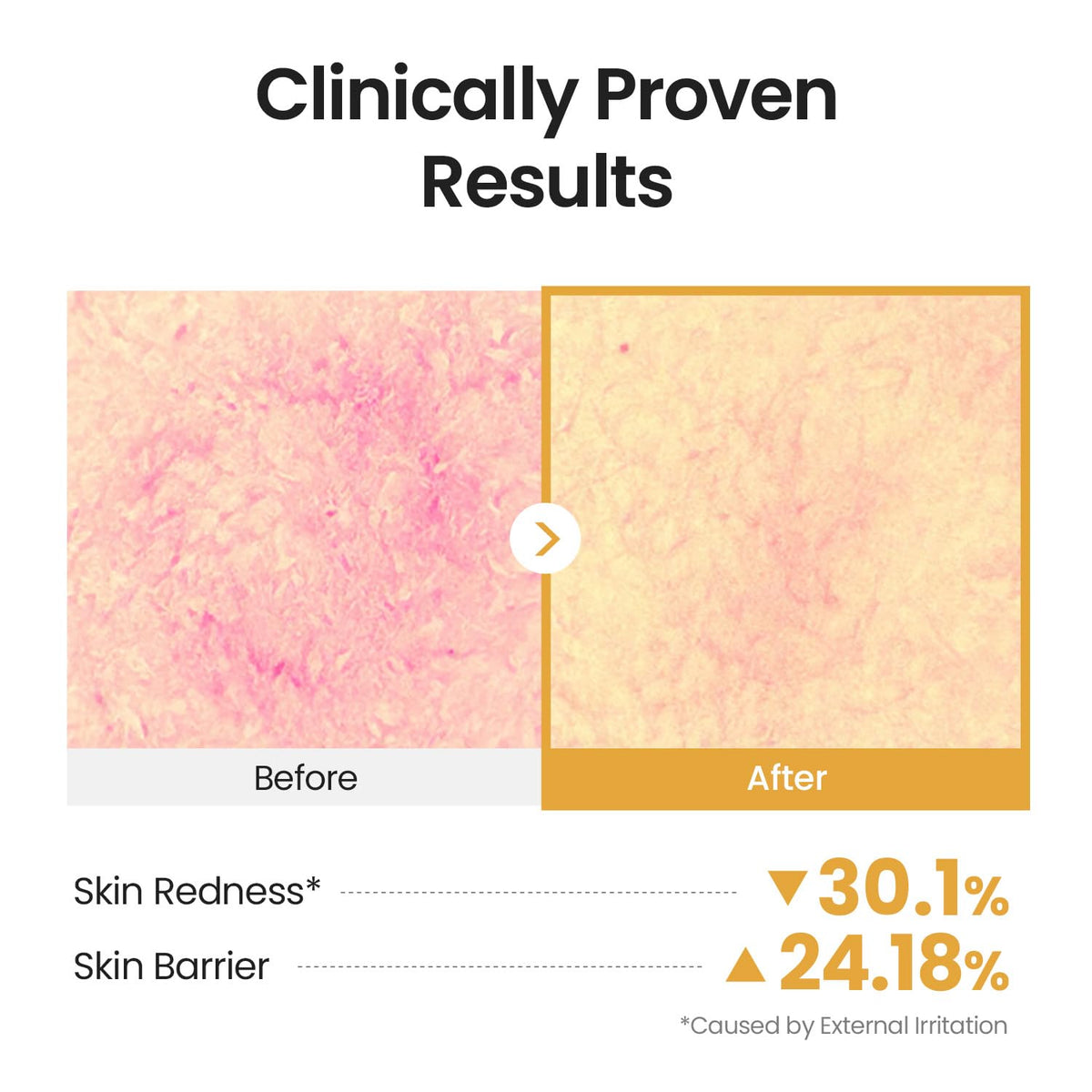SKINFOOD Royal Honey Propolis Enrich Barrier Cream 63mL original Amazon English clinical results with external-irritation footnote