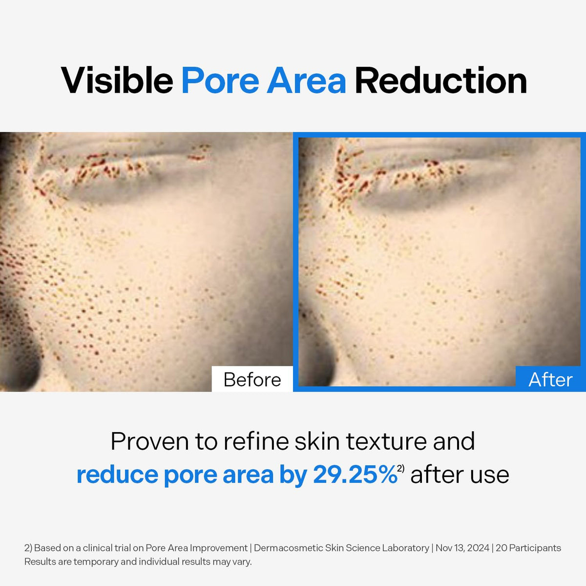 Torriden DIVE IN Cleansing Oil Pore area results