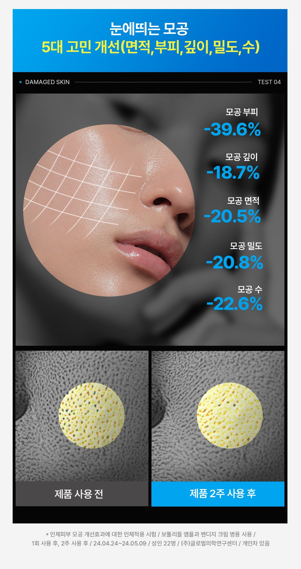 WELLAGE Hyper Peptide Botuleedle 1000 Ampoule five pore concerns test official information