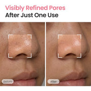 Strawberry Sugar Food Mask 4.23 oz - Pore appearance before and after