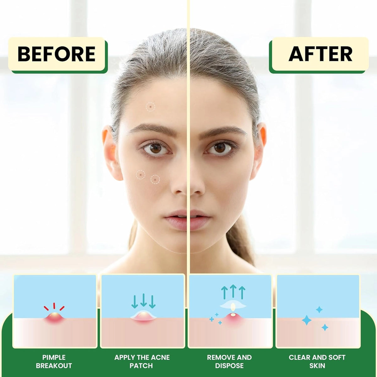 Elemental Wellness Hydrocolloid Acne Patches, 36 Count