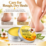 Manuka Honey Foot Balm for Dry Cracked Heels & Rough Feet