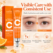 SADOER 5X Vitamin C Eye Cream for Dark Circles