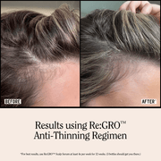 California Naturals Re:GRO Anti-Thinning Shampoo 16.5 fl oz - AHVTE