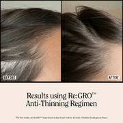 California Naturals Re:GRO Anti-Thinning Shampoo 16.5 fl oz - AHVTE