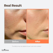 Isntree Green Tea Fresh Toner 200mL official appearance demonstration