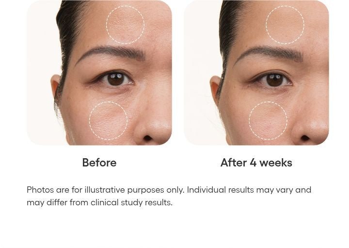 LANEIGE Balance Mode Shine Control Weightless Moisturizer official panel: Before After 4 weeks Photos are for illustrative purposes only. Individual results may vary and may differ from clinical study results.