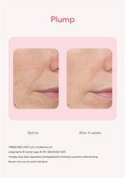 LANEIGE Bouncy & Firm Serum official plump before after