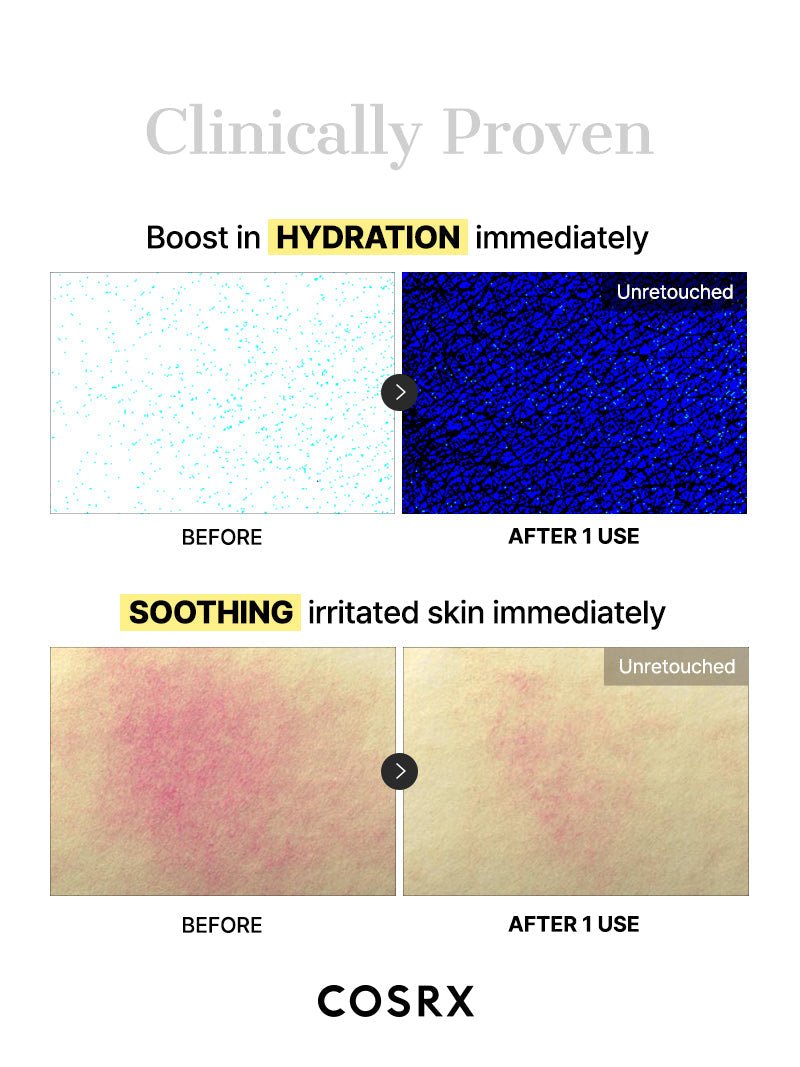 Advanced Snail Mucin Glass Glow Hydrogel Mask official English detail panel 6