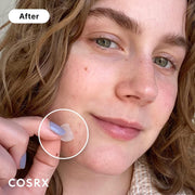 COSRX Acne Pimple Master Patch 24 Patches English Amazon product information 2