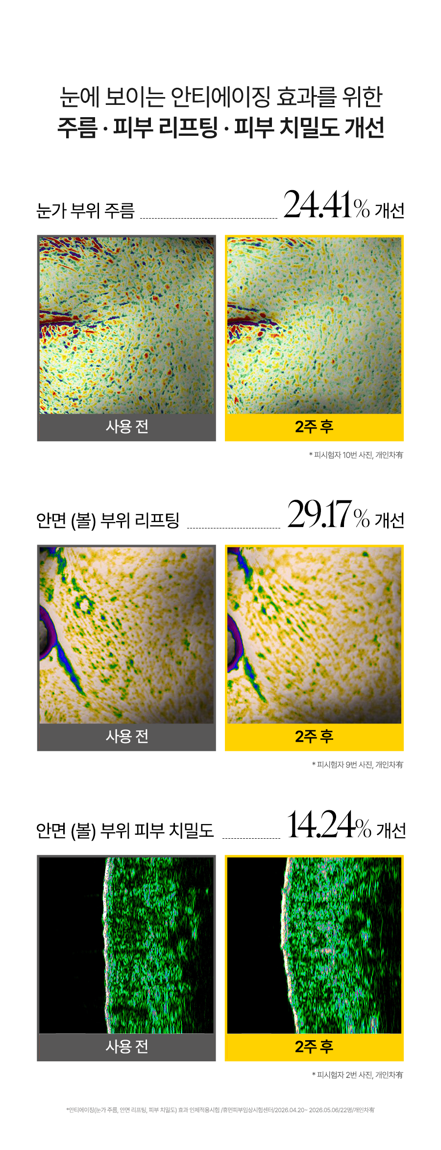 d'Alba Wrinkle lifting and density results original Korean source panel