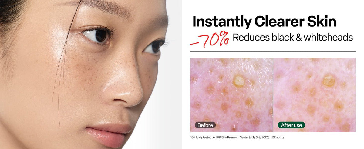 Dr.G Brightening Vita Peeling Pads 70 Pads - clearer skin results