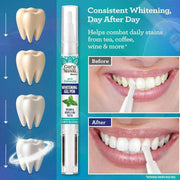 GuruNanda LLC – wholesale Teeth Whitener – Whitening Gel Pen – 1.8mL2
