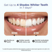 GuruNanda LLC – wholesale Teeth Whitener – Whitening Strips – 7 Day Treatment1