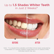 GuruNanda LLC – wholesale Teeth Whitener – Sensitive Whitening Strips1