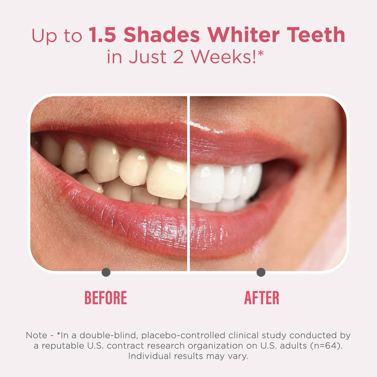 GuruNanda LLC – wholesale Teeth Whitener – Sensitive Whitening Strips1