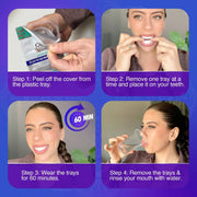 GuruNanda Professional Whitening Trays supplier image 6