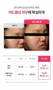 FATION Nosca9 Soothing Pad: two week results