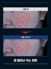 FATION Mela Zero Cream 50mL four week surface comparison