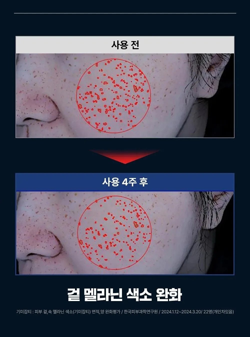 FATION Mela Zero Cream 50mL four week surface comparison