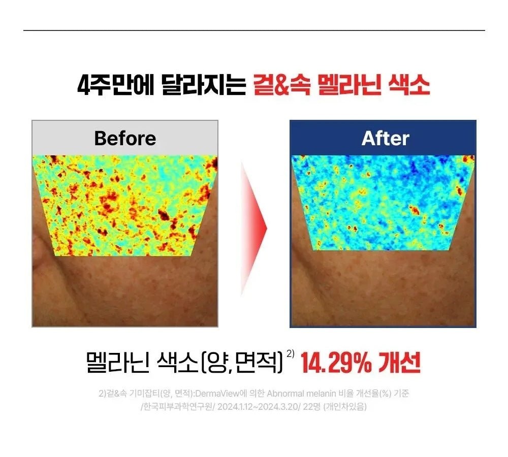 FATION Mela Zero Cream 50mL four week study