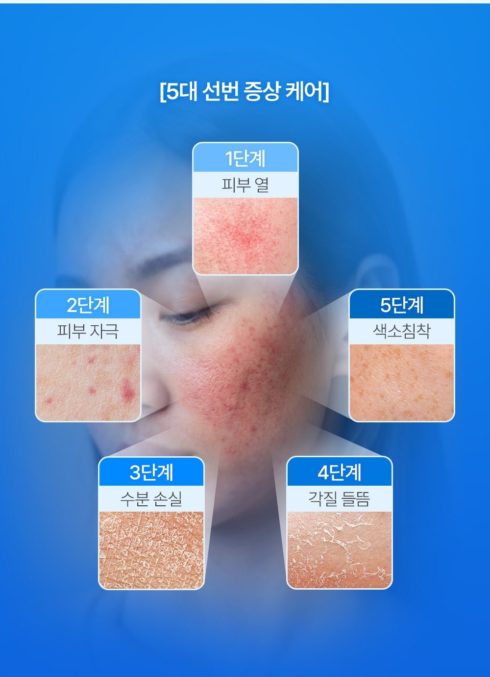 FATION After Sun Gel Lotion - care focus (official Korean source)