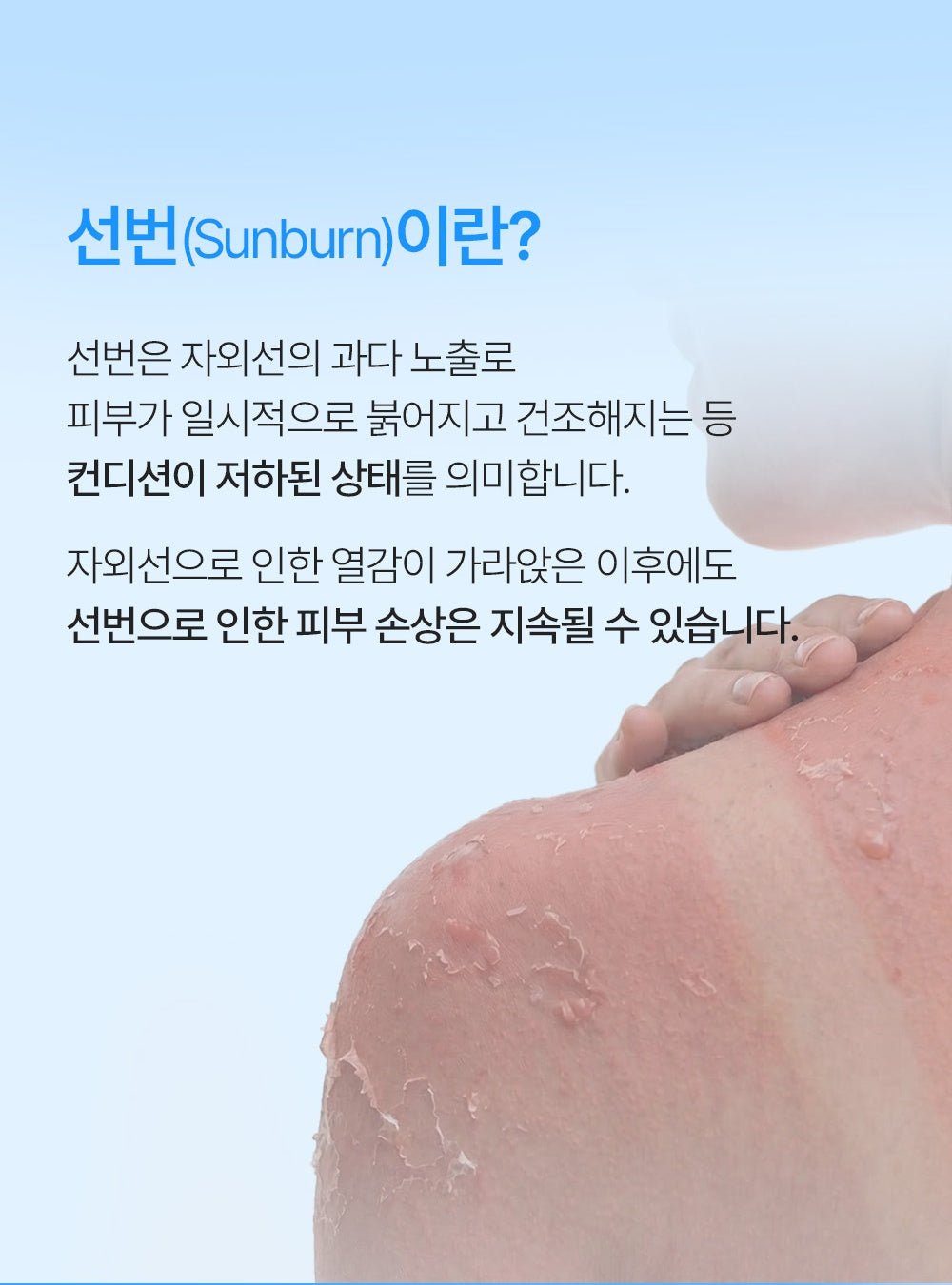 FATION After Sun Gel Lotion - sun exposure context (official Korean source)