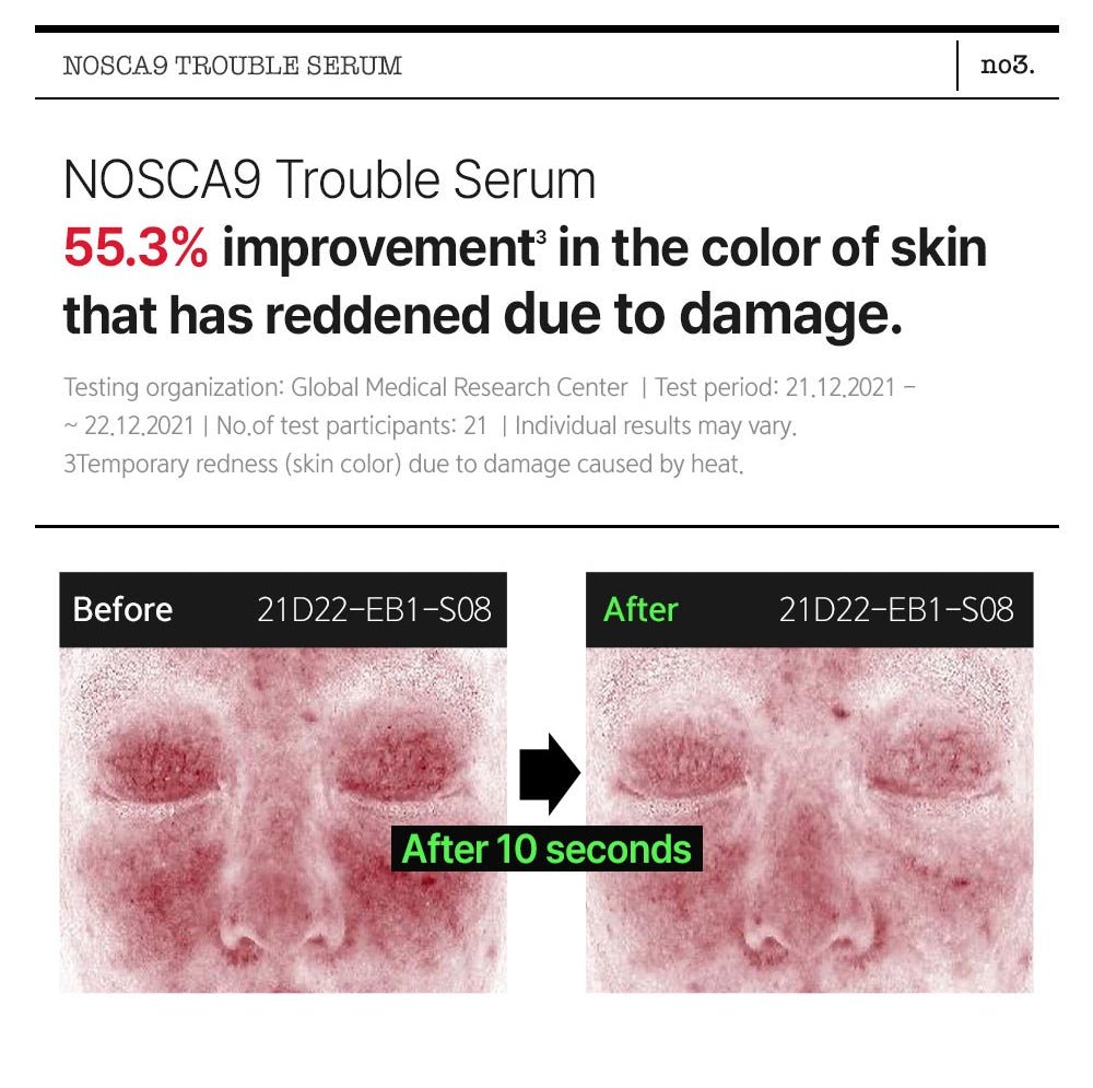 FATION Nosca9 Trouble Serum official point 3 panel