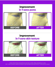 FATION Nosca9 Pore Enhancing Serum: tzone overview